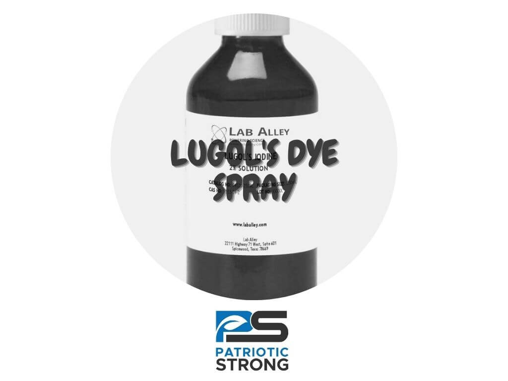 LUGOL’S DYE SPRAY CHROMOENDOSCOPY ESTABLISHES EARLY DIAGNOSIS OF ESOPHAGEAL CANCER IN PATIENTS WITH PRIMARY HEAD AND NECK CANCER – Patriotic Strong Lugol’s Iodide